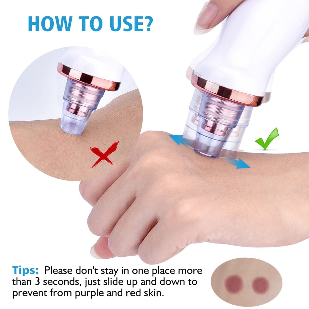 Original 5-in-1 Blackhead remover ❤️With Rechargeable 🔋