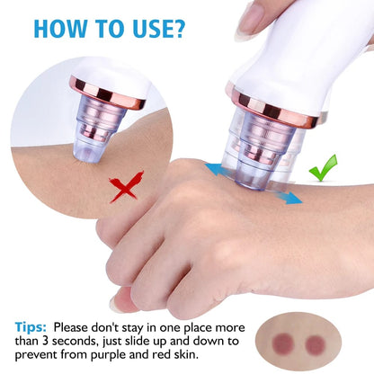 Original 5-in-1 Blackhead remover ❤️With Rechargeable 🔋