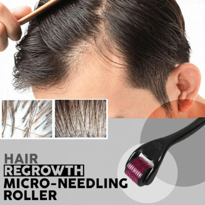 Derma Roller 0.5mm With 540 Micro Needle For Hair Growth 🔥🕛